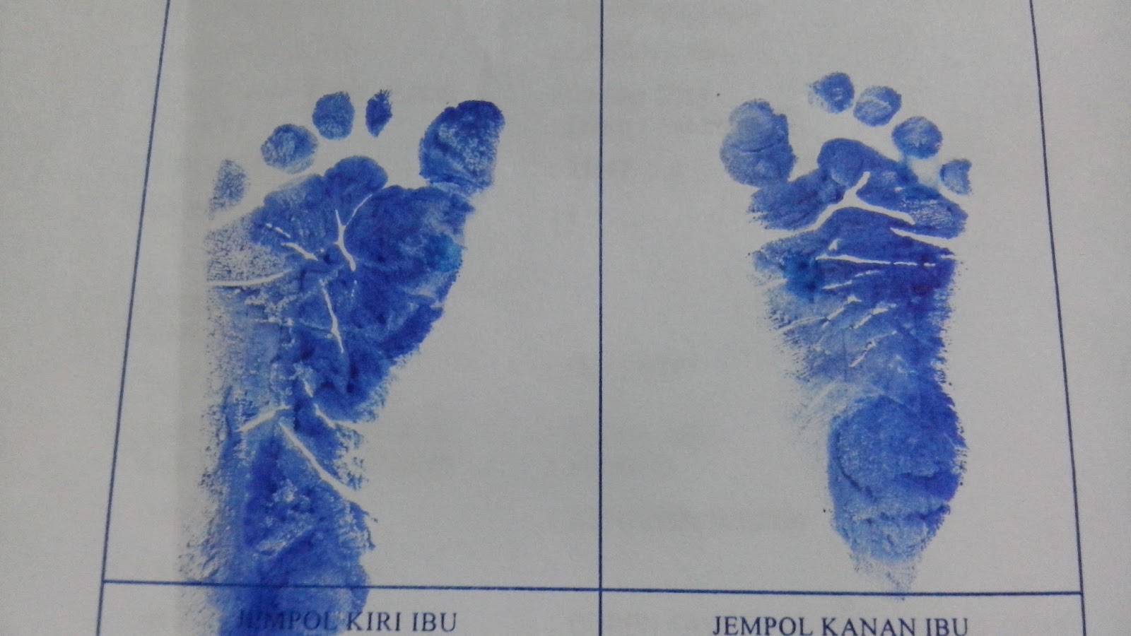 METAMORPHOSIS Cerita Kelahiran Xiao Dre