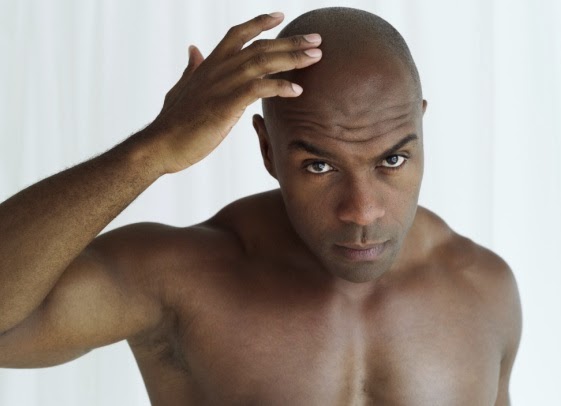 Slim Hair Beauty Hair Loss Treatment Men Need To Know About