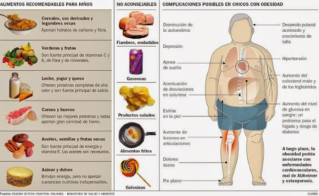 Resultado de imagen para obesidad infantil