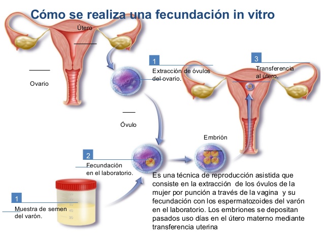 Cuanto cuesta la fecundacion in vitro