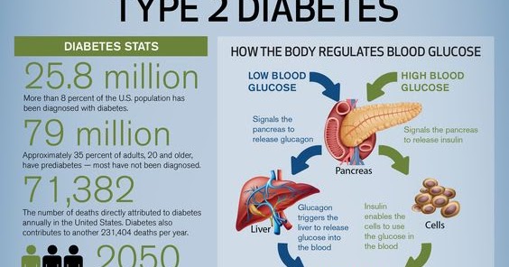 Losing Weight as a Cure for Type 2 Diabetes