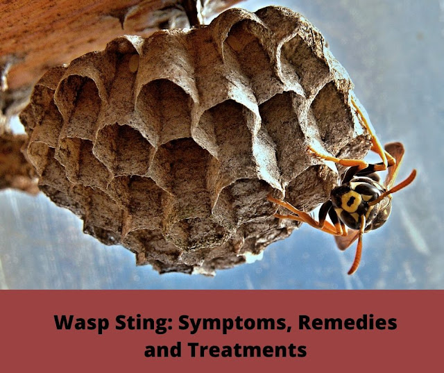 Wasp Sting: Symptoms, Remedies and Treatments