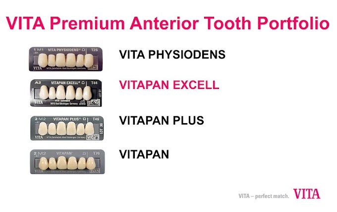 PROSTHODONTICS: VITAPAN EXCELL Overview by Jim McGuire, CDT