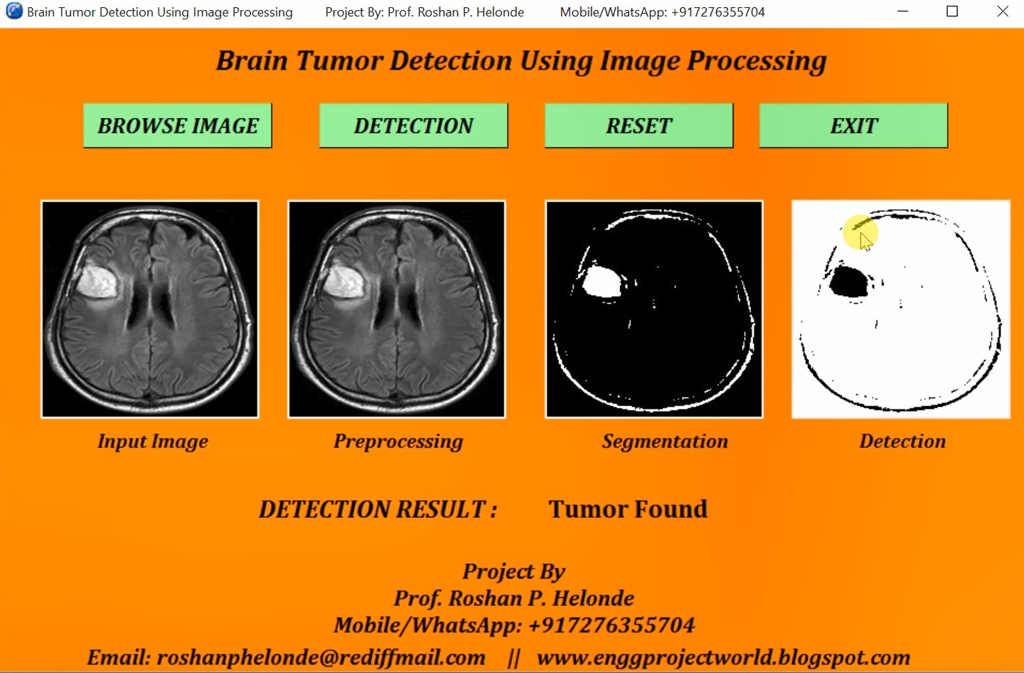 research papers on medical image processing based on tumor detection