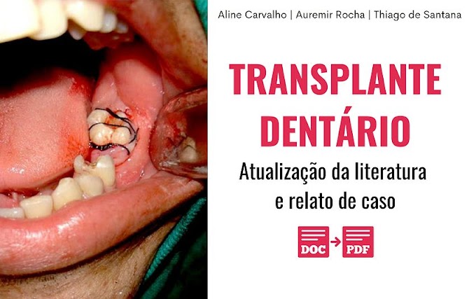 PDF: Transplante Dentário - Atualização da literatura e relato de caso