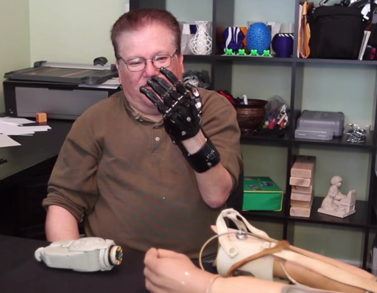 DIY 3D Printing: DIY 3d printed 50 $ prosthetic hand vs ...