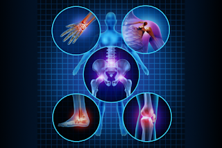 Arthritis Symptoms and Causes