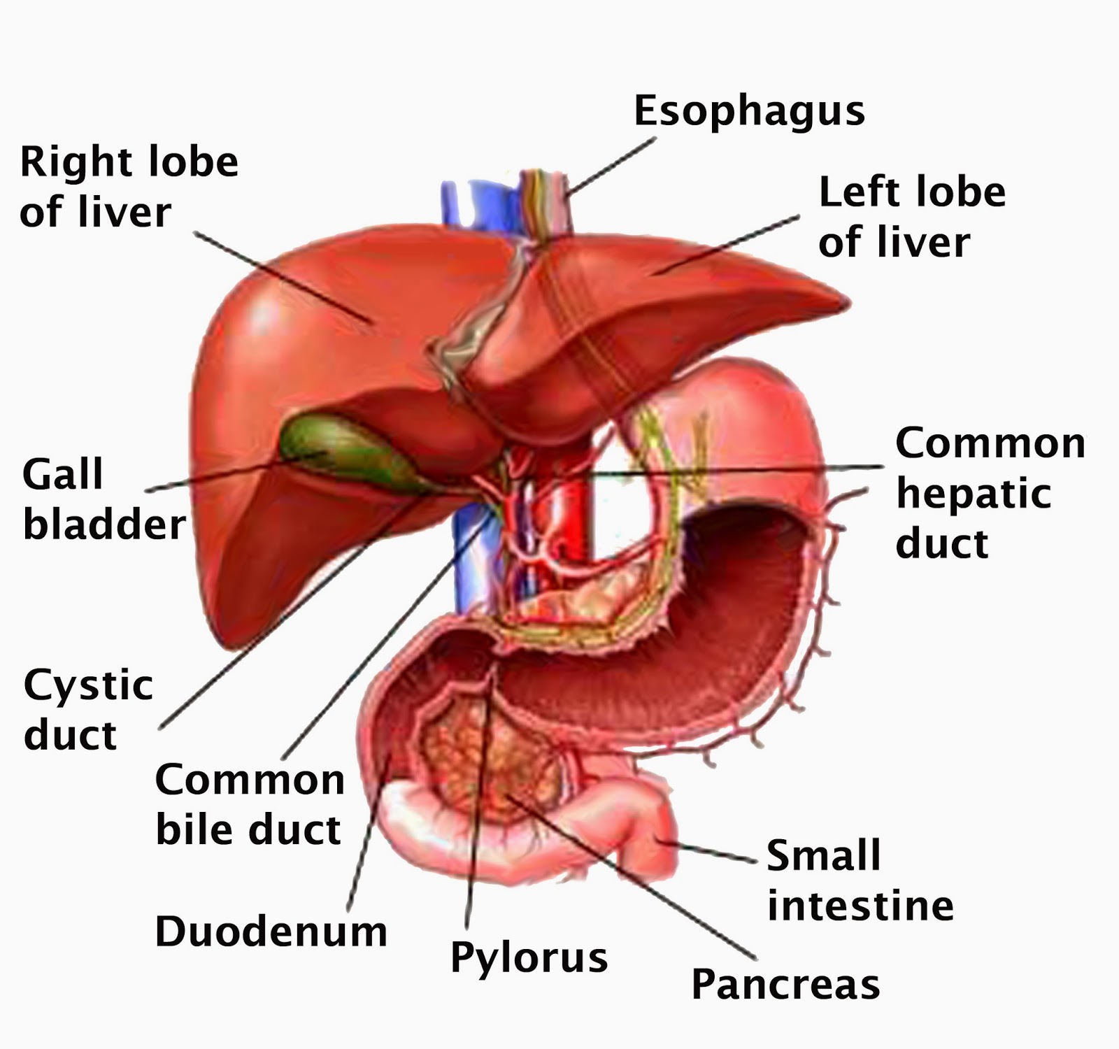   Cirrhosis of the Liver The liver, the largest organ in the body, is essential in keeping the body functioning properly. It removes or neutralizes poisons from the blood, produces immune agents to control infection, and removes germs and bacteria from the blood. It makes proteins that regulate blood clotting and produces bile to help absorb fats and fat-soluble vitamins. You cannot live without a functioning liver. In cirrhosis of the liver, scar tissue replaces normal, healthy tissue, blocking the flow of blood through the organ and preventing it from working as it should. Cirrhosis is the twelfth leading cause of death by disease, killing about 26,000 people each year. Also, the cost of cirrhosis in terms of human suffering, hospital costs, and lost productivity is high.  Causes Cirrhosis has many causes. In the United States, chronic alcoholism and hepatitis C are the most common ones.  Alcoholic liver disease. To many people, cirrhosis of the liver is synonymous with chronic alcoholism, but in fact, alcoholism is only one of the causes. Alcoholic cirrhosis usually develops after more than a decade of heavy drinking. The amount of alcohol that can injure the liver varies greatly from person to person. In women, as few as two to three drinks per day have been linked with cirrhosis and in men, as few as three to four drinks per day. Alcohol seems to injure the liver by blocking the normal metabolism of protein, fats, and carbohydrates.  Chronic hepatitis C. The hepatitis C virus ranks with alcohol as a major cause of chronic liver disease and cirrhosis in the United States. Infection with this virus causes inflammation of and low grade damage to the liver that over several decades can lead to cirrhosis.  Chronic hepatitis B and D. The hepatitis B virus is probably the most common cause of cirrhosis worldwide, but it is less common in the United States and the Western world. Hepatitis B, like hepatitis C, causes liver inflammation and injury that over several decades can lead to cirrhosis. Hepatitis D is another virus that infects the liver, but only in people who already have hepatitis B.  Autoimmune hepatitis. This disease appears to be caused by the immune system attacking the liver and causing inflammation, damage, and eventually scarring and cirrhosis.  Inherited diseases. Alpha-1 antitrypsin deficiency, hemochromatosis, Wilson disease, galactosemia, and glycogen storage diseases are among the inherited diseases that interfere with the way the liver produces, processes, and stores enzymes, proteins, metals, and other substances the body needs to function properly.  Non alcoholic steatohepatitis (NASH). In NASH, fat builds up in the liver and eventually causes scar tissue. This type of hepatitis appears to be associated with diabetes, protein malnutrition, obesity, coronary artery disease, and treatment with corticosteroid medications.  Blocked bile ducts. When the ducts that carry bile out of the liver are blocked, bile backs up and damages liver tissue. In babies, blocked bile ducts are most commonly caused by biliary atresia, a disease in which the bile ducts are absent or injured. In adults, the most common cause is primary biliary cirrhosis, a disease in which the ducts become inflamed, blocked, and scarred. Secondary biliary cirrhosis can happen after gallbladder surgery if the ducts are inadvertently tied off or injured.  Drugs, toxins, and infections. Severe reactions to prescription drugs, prolonged exposure to environmental toxins, the parasitic infection schistosomiasis, and repeated bouts of heart failure with liver congestion can all lead to cirrhosis.  Symptoms Many people with cirrhosis have no symptoms in the early stages of the disease. However, as scar tissue replaces healthy cells, liver function starts to fail and a person may experience the following symptoms: • exhaustion • fatigue • loss of appetite • nausea • weakness • weight loss • abdominal pain  • spider-like blood vessels (spider angiomas) that develop on the skin As the disease progresses, complications may develop. In some people, these may be the first signs of the disease.  Complications of Cirrhosis Loss of liver function affects the body in many ways. Following are the common problems, or complications, caused by cirrhosis.  Oedema and ascites. When the liver loses its ability to make the protein albumin, water accumulates in the legs (oedema) and abdomen (ascites).  Bruising and bleeding. When the liver slows or stops production of the proteins needed for blood clotting, a person will bruise or bleed easily. The palms of the hands may be reddish and blotchy with palmar erythema.  Jaundice. Jaundice is a yellowing of the skin and eyes that occurs when the diseased liver does not absorb enough bilirubin.  Itching. Bile products deposited in the skin may cause intense itching.  Gallstones. If cirrhosis prevents bile from reaching the gallbladder, gallstones may develop.  Toxins in the blood or brain. A damaged liver cannot remove toxins from the blood, causing them to accumulate in the blood and eventually the brain. There, toxins can dull mental functioning and cause personality changes, coma, and even death. Signs of the build-up of toxins in the brain include neglect of personal appearance, unresponsiveness, forgetfulness, trouble concentrating, or changes in sleep habits.  Sensitivity to medication. Cirrhosis slows the liver's ability to filter medications from the blood. Because the liver does not remove drugs from the blood at the usual rate, they act longer than expected and build up in the body. This causes a person to be more sensitive to medications and their side effects.  Portal hypertension. Normally, blood from the intestines and spleen is carried to the liver through the portal vein. But cirrhosis slows the normal flow of blood through the portal vein, which increases the pressure inside it. This condition is called portal hypertension.  Varices. When blood flow through the portal vein slows, blood from the intestines and spleen backs up into blood vessels in the stomach and oesophagus. These blood vessels may become enlarged because they are not meant to carry this much blood. The enlarged blood vessels, called varices, have thin walls and carry high pressure, and thus are more likely to burst. If they do burst, the result is a serious bleeding problem in the upper stomach or oesophagus that requires immediate medical attention.  Insulin resistance and type 2 diabetes. Cirrhosis causes resistance to insulin. This hormone, produced by the pancreas, enables blood glucose to be used as energy by the cells of the body. If you have insulin resistance, your muscle, fat, and liver cells do not use insulin properly. The pancreas tries to keep up with the demand for insulin by producing more. Eventually, the pancreas cannot keep up with the body's need for insulin, and type 2 diabetes develops as excess glucose builds up in the bloodstream.  Liver cancer. Hepato cellular carcinoma, a type of liver cancer commonly caused by cirrhosis, starts in the liver tissue itself. It has a high mortality rate.  Problems in other organs. Cirrhosis can cause immune system dysfunction, leading to infection. Fluid in the abdomen (ascites) may become infected with bacteria normally present in the intestines. Cirrhosis can also lead to impotence, kidney dysfunction and failure, and osteoporosis.  Diagnosis The doctor may diagnose cirrhosis on the basis of symptoms, laboratory tests, the medical history, and a physical examination. For example, during a physical examination, the doctor may notice that the liver feels harder or larger than usual and order blood tests that can show whether liver disease is present. If looking at the liver is necessary to check for signs of disease, the doctor might order a computerized axial tomography (CAT) scan, ultrasound, magnetic resonance imaging (MRI), or a scan of the liver using a radioisotope (a harmless radioactive substance that highlights the liver). Or the doctor might look at the liver using a laparoscope, an instrument that is inserted through the abdomen and relays pictures back to a computer screen. A liver biopsy will confirm the diagnosis. For a biopsy, the doctor uses a needle to take a tiny sample of liver tissue, then examines it under the microscope for scarring or other signs of disease.  Treatment Liver damage from cirrhosis cannot be reversed, but treatment can stop or delay further progression and reduce complications. Treatment depends on the cause of cirrhosis and any complications a person is experiencing. For example, cirrhosis caused by alcohol abuse is treated by abstaining from alcohol. Treatment for hepatitis-related cirrhosis involves medications used to treat the different types of hepatitis, In all cases, regardless of the cause, following a healthy diet and avoiding alcohol are essential because the body needs all the nutrients it can get, and alcohol will only lead to more liver damage. Light physical activity can help stop or delay cirrhosis as well. Treatment will also include remedies for complications. For example, for ascites and oedema, the doctor may recommend a low-sodium diet or the use of diuretics, which are drugs that remove fluid from the body. Protein causes toxins to form in the digestive tract, so eating less protein will help decrease the build-up of toxins in the blood and brain. The doctor may also prescribe laxatives to help absorb the toxins and remove them from the intestines. For portal hypertension, the doctor may prescribe a blood pressure medication.  When complications cannot be controlled or when the liver becomes so damaged from scarring that it completely stops functioning, a liver transplant is necessary. In liver transplantation surgery, a diseased liver is removed and replaced with a healthy one from an organ donor. About 80 to 90 percent of patients survive liver transplantation. Survival rates have improved over the past several years because of drugs.   Homeopathy medicines Treatment for Liver Problems  Symptomatic Homeopathy works well for Liver Problems, So its good to consult a experienced Homeopathy physician without any hesitation.    Whom to contact for Liver Problems Treatment  Dr.Senthil Kumar Treats many cases of Liver Problems, In his medical professional experience with successful results. Many patients get relief after taking treatment from Dr.Senthil Kumar.  Dr.Senthil Kumar visits Chennai at Vivekanantha Homeopathy Clinic, Velachery, Chennai 42. To get appointment please call 9786901830, +91 94430 54168 or mail to consult.ur.dr@gmail.com,    For more details & Consultation Feel free to contact us. Vivekanantha Clinic Consultation Champers at Chennai:- 9786901830  Panruti:- 9443054168  Pondicherry:- 9865212055 (Camp) Mail : consult.ur.dr@gmail.com, homoeokumar@gmail.com   For appointment please Call us or Mail Us  For appointment: SMS your Name -Age – Mobile Number - Problem in Single word - date and day - Place of appointment (Eg: Rajini – 30 - 99xxxxxxx0 – Hepatitis, Jaundice, HbsAg Positive,  – 21st Oct, Sunday - Chennai ), You will receive Appointment details through SMS