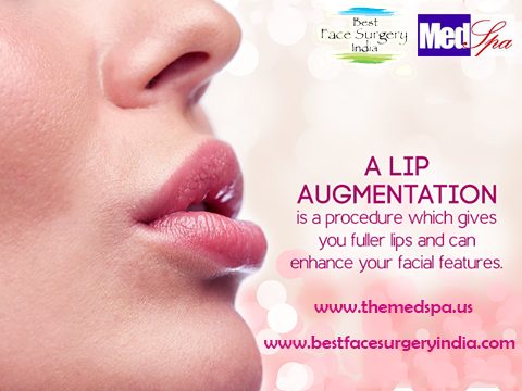 lip augmentation in Delhi