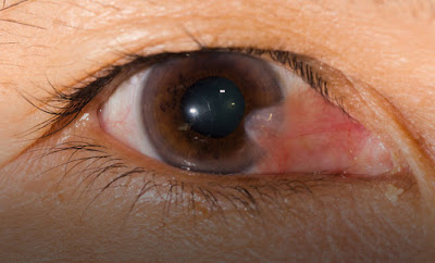FUNDAR clínica de ojos y la vista