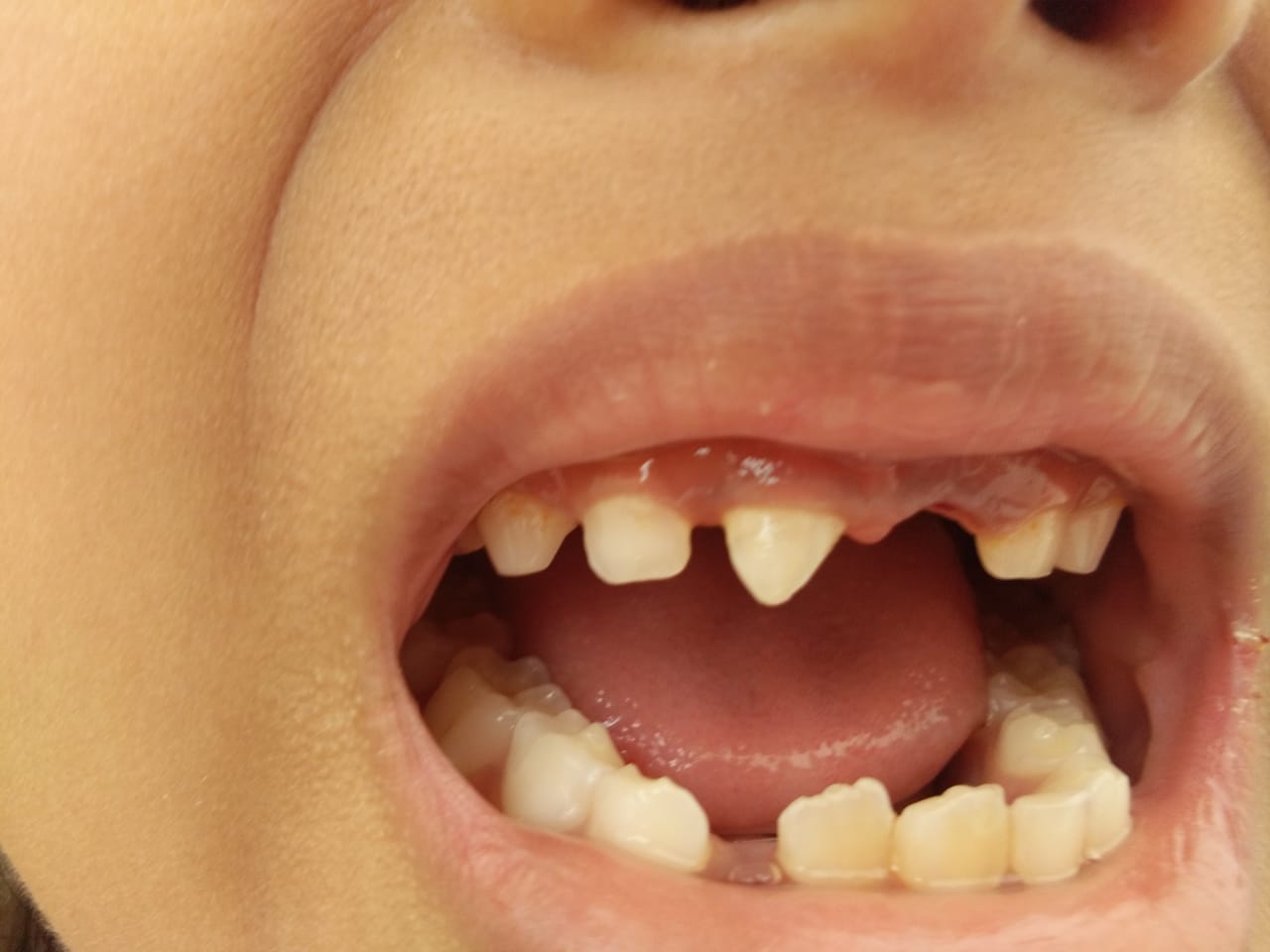 contoh gambar gigi lengkap