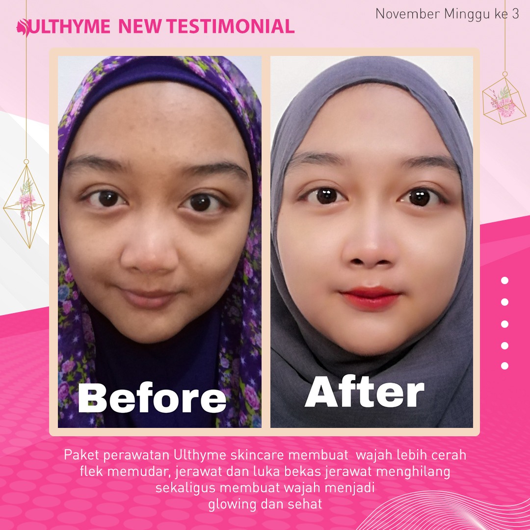 ulthyme skincare