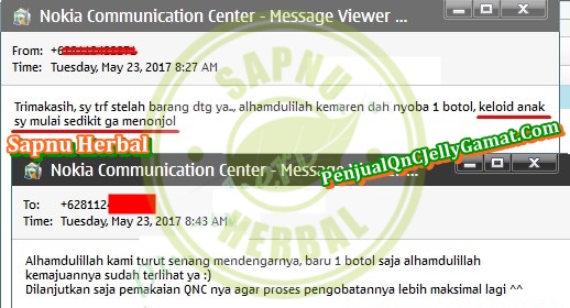Cara Menghilangkan Keloid di Payudara Secara Alami dan Aman Cara Menghilangkan Keloid di Payudara Secara Alami dan Aman