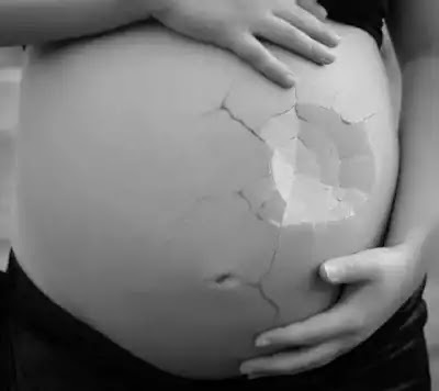 How to Prevent a Miscarriage and what his Signs, Symptoms and Treatment How to Prevent a Miscarriage and what his Signs, Symptoms and Treatment