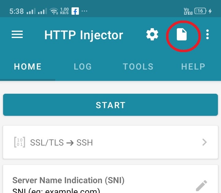EHI LANKA HOW TO IMPORT EHI CONFIG FILE ON HTTP INJECTOR APP
