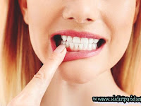 Tips Alami Mengurangi Rasa Nyeri Pada Gigi