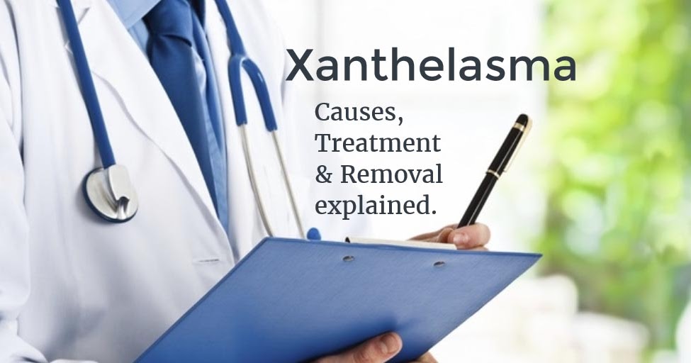 XANTHEL, Xanthelasma Removal Cream Xanthelasma And Xantomas Defined