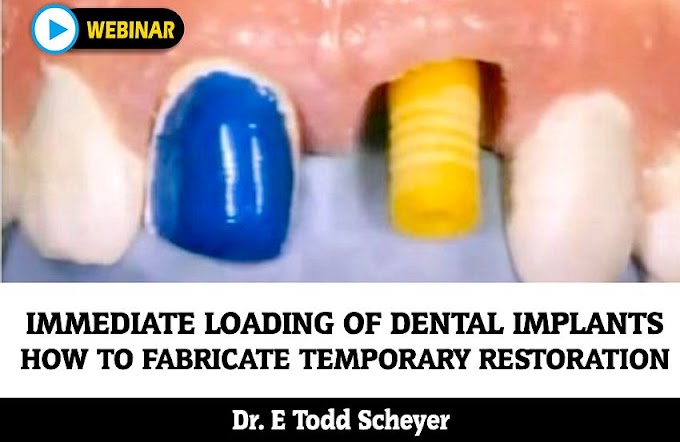 WEBINAR: Immediate Loading of Dental Implants - How to Fabricate the Ideal Temporary Restoration - Dr. E. Todd Scheyer