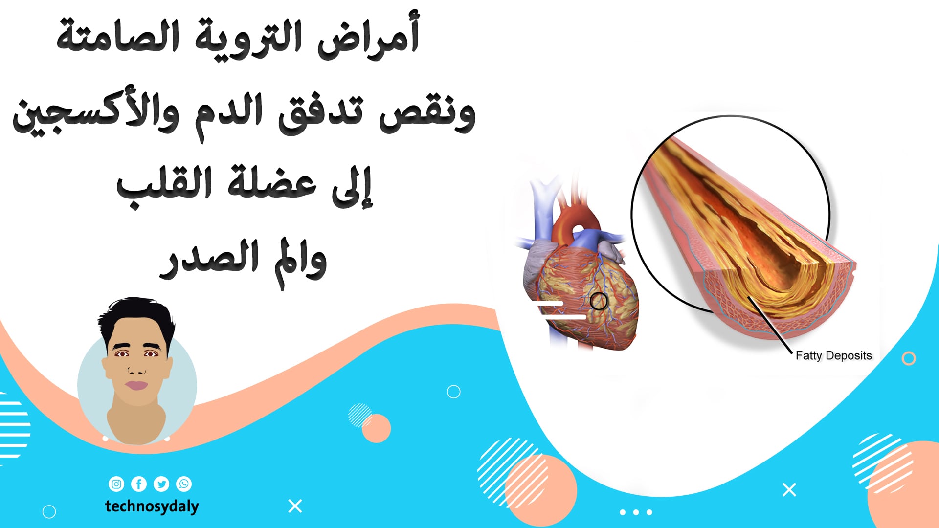 أمراض التروية الصامتة ونقص تدفق الدم والأكسجين إلى عضلة القلب والم الصدر أمراض التروية الصامتة ونقص تدفق الدم والأكسجين إلى عضلة القلب والم الصدر