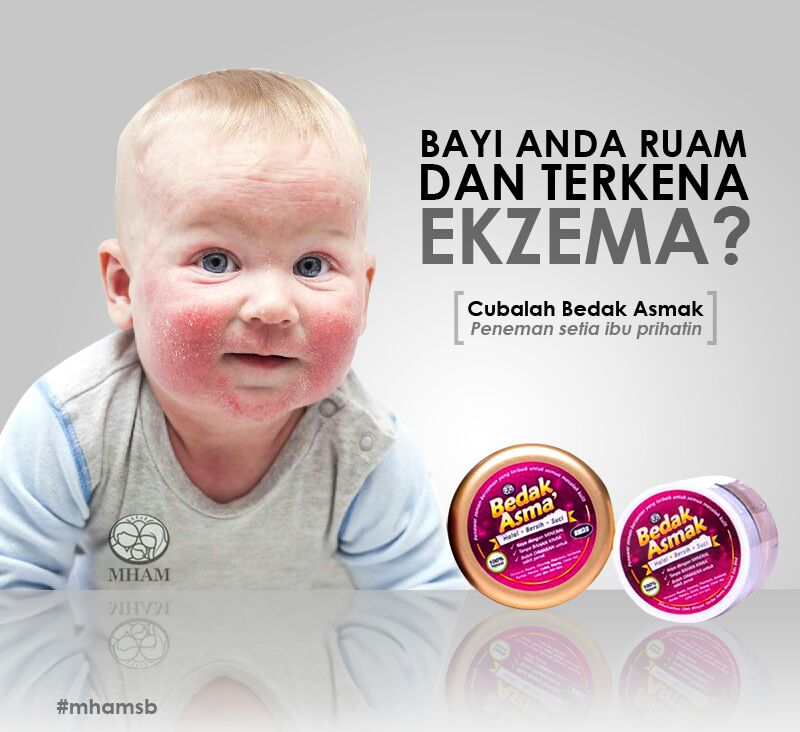 Doa Penyakit Kulit Eczema / Doktor Ini Kongsi Rawatan Asas