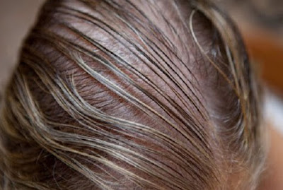 Tìm hiểu về căn bệnh mất tóc ở phụ nữ Nguyen-nhan-dan-toi-mat-toc
