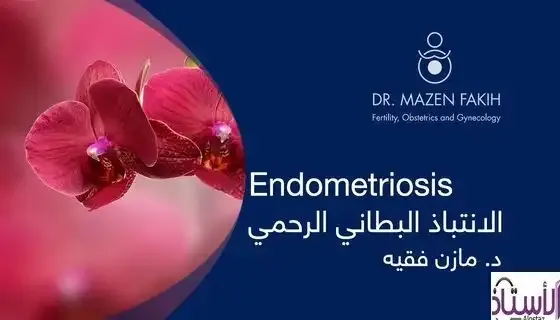 Endometriosis treatment