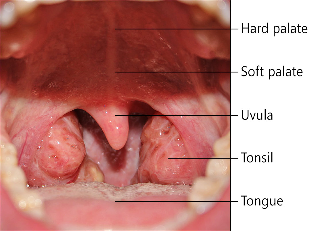normal healthy throat tonsils