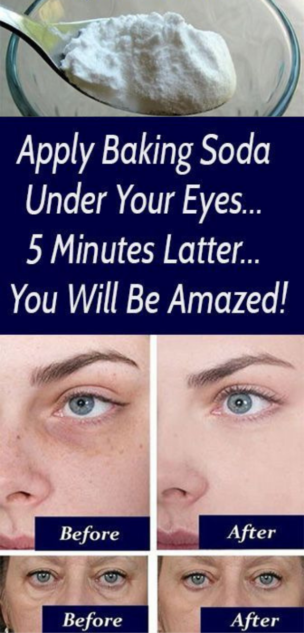 Apply Baking Soda Under Your Eyes… 5 Minutes Latter… You Will be Amazed!