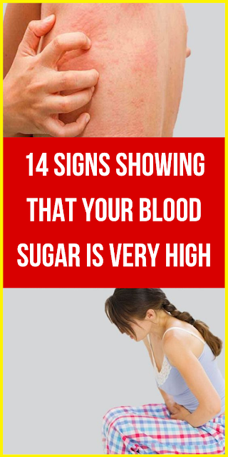 Signs Of High Blood Sugar Level That Everyone Ignores | Wellness Today