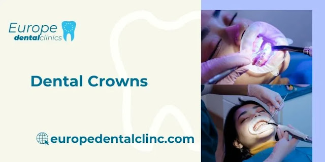 Dental Crowns - Europe Dental Clinic
