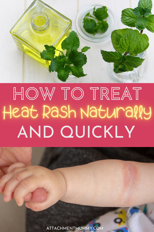 How to Treat Heat Rash Naturally