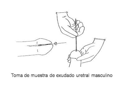 Toma de muestra exudado uretra masculina