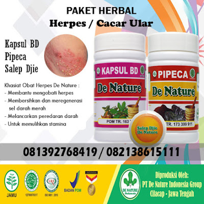 Obat apotik dan herbal untuk menyembuhkan penyakit herpes