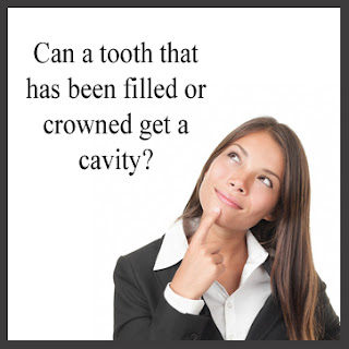 Brampton Dentist, Dentist in Brampton, Cavities, Crowns, Brampton Family Dentist,