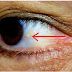 SUS OJOS PUEDE INDICAR SI ESTÁ A PUNTO DE SUFRIR UN ACCIDENTE CEREBROVASCULAR