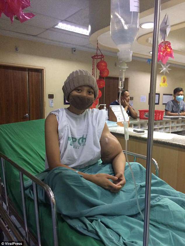 ''Ingatkan Bekas Gigitan Nyamuk, Rupanya Kanser Bila Tangan Bengkak Tiba-Tiba'', Lengan Gadis Ini Terpaksa Dipotong ''Ingatkan Bekas Gigitan Nyamuk, Rupanya Kanser Bila Tangan Bengkak Tiba-Tiba'', Lengan Gadis Ini Terpaksa Dipotong