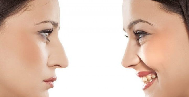 Burun Estetiği Rinoplasti Gezilmeye Değer Yerler Seyahat Tur Rehberi