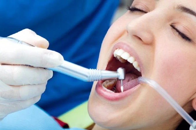 These are the causes of cavities that you need to avoid