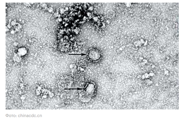 Фото коронавируса из Китая под микроскопом