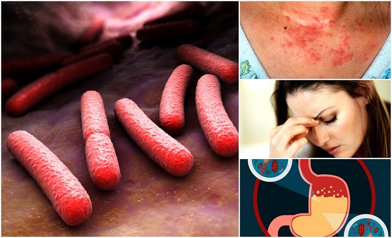 7 Signs You Desperately Need More Probiotics And How To Get Them 7 Signs You Desperately Need More Probiotics And How To Get Them