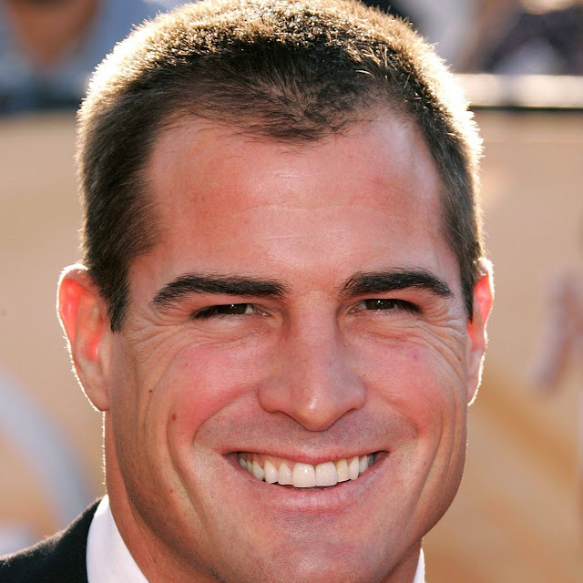 Cool Balding Hairstyles Ideas | Balding Hairstyles