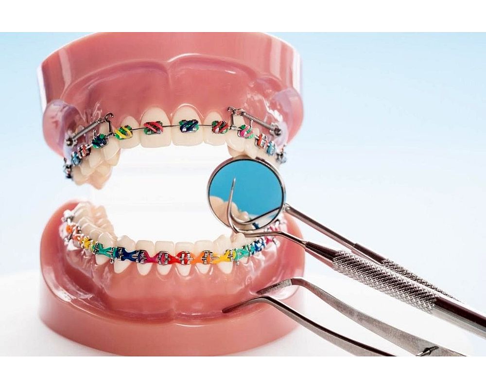 Can Someone With Periodontal Disease Get Braces? OdontoVida