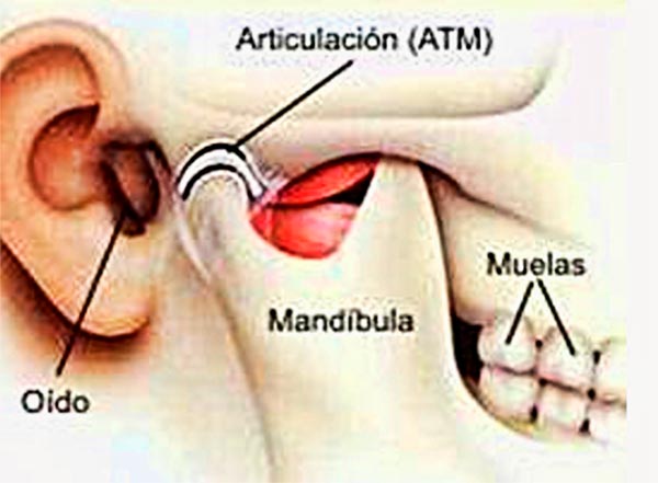 Que hacer con dolor de oido