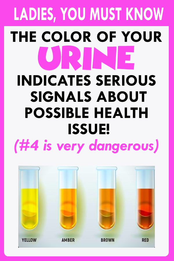 What the color of your urine and frequent urination can tell you about