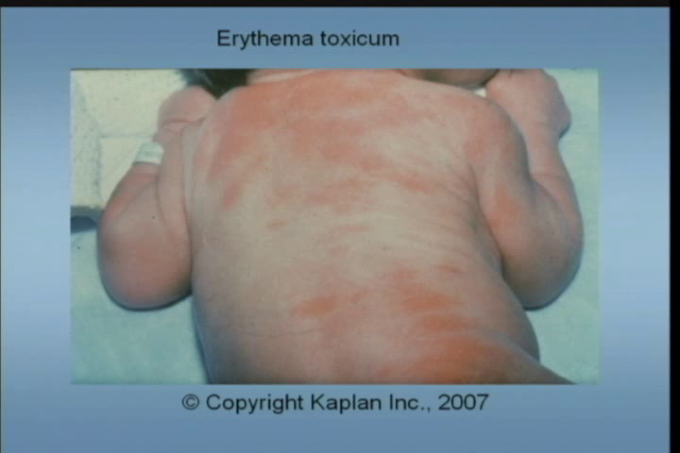 Examinaton of baby and abnormal findings