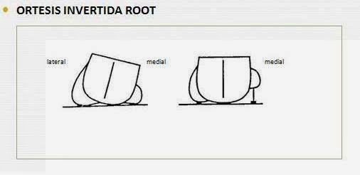 Ortopodologia y Biomecanica : ORTESIS INVERTIDAS: TIPOS, INDICACIONES Y ...
