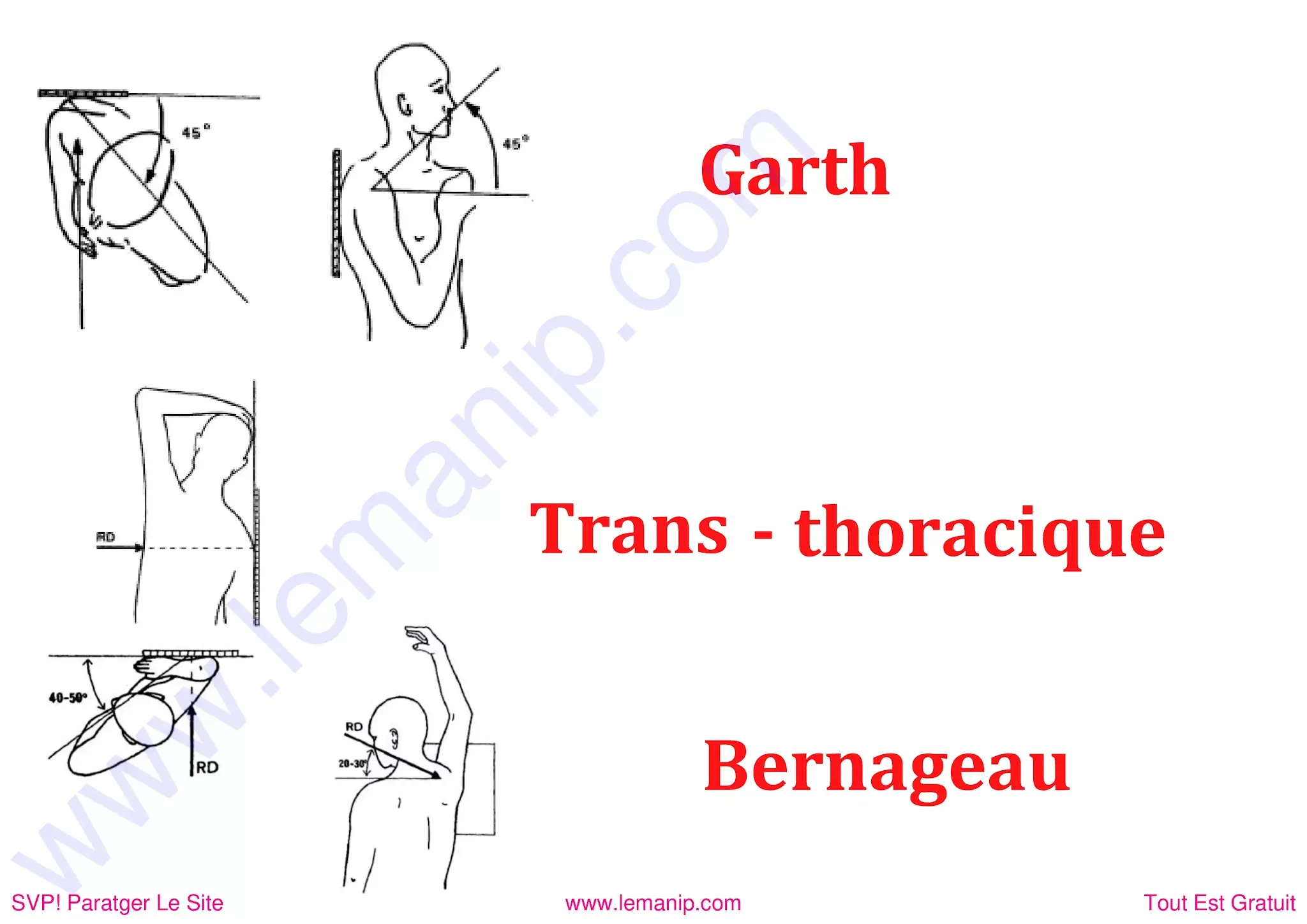 Trans toracique bernageau