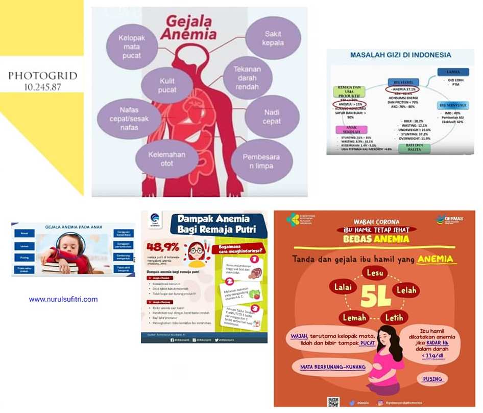 Putuskan Mata Rantai Anemia Defisiensi Besi dengan Edukasi Gizi Menyeluruh Nurul Sufitri Travel Lifestyle Blogger