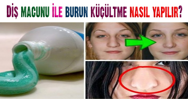 Yurt dışında popüler&hellip;Diş macunu ile burun küçültme nasıl yapılır