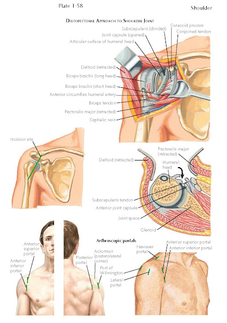 COMMON SURGICAL APPROACHES TO THE SHOULDER